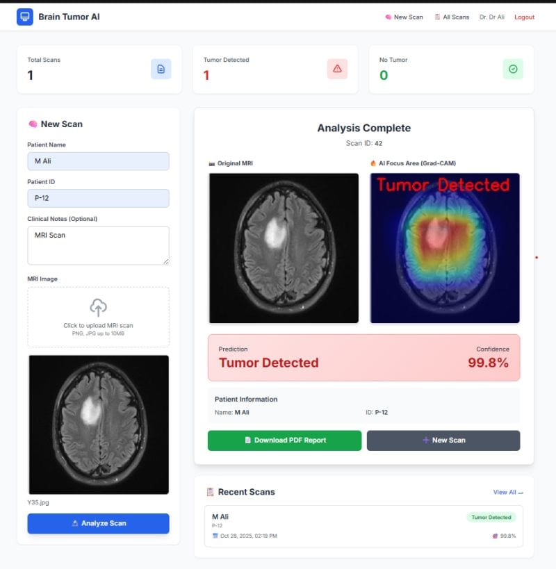 Brain Tumor Detection Web App screenshot
